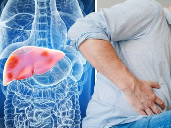 Ung thư gan giai đoạn cuối có thể sống thêm bao lâu?