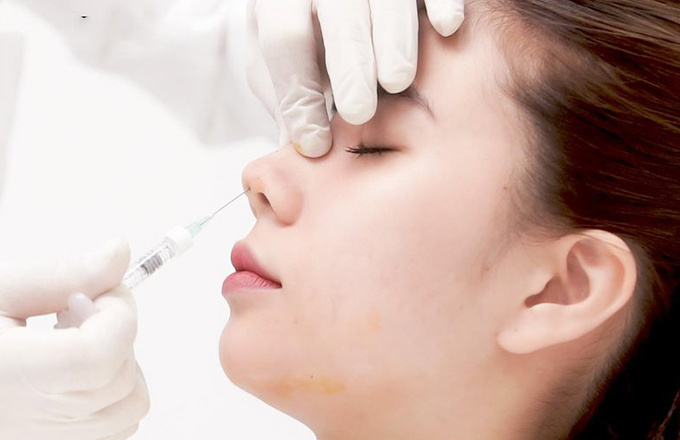 Cô gái 27 tuổi bị mù mắt phải sau khi tiêm filler nâng mũi