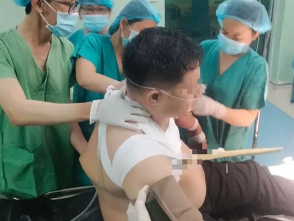 Ớn lạnh người đàn ông bị cây gỗ đâm xuyên ngực, thủng phổi