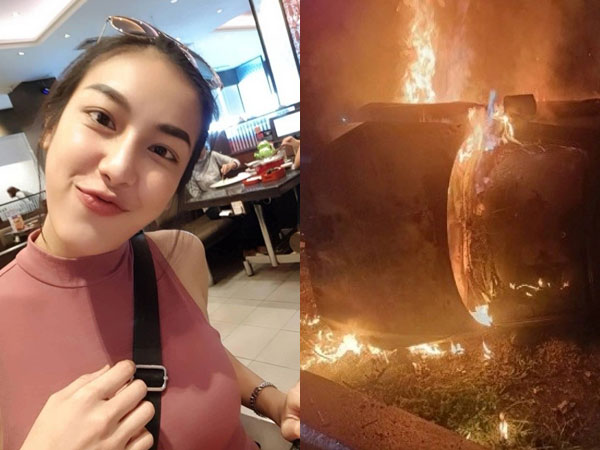 Tai nạn nghiêm trọng, chân dài Thái Lan bị cháy đen, người thân bật khóc, làng giải trí đau lòng