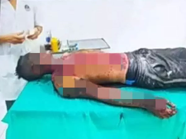Nổ bình oxy kinh hoàng, thanh niên nguy kịch vì bỏng nặng