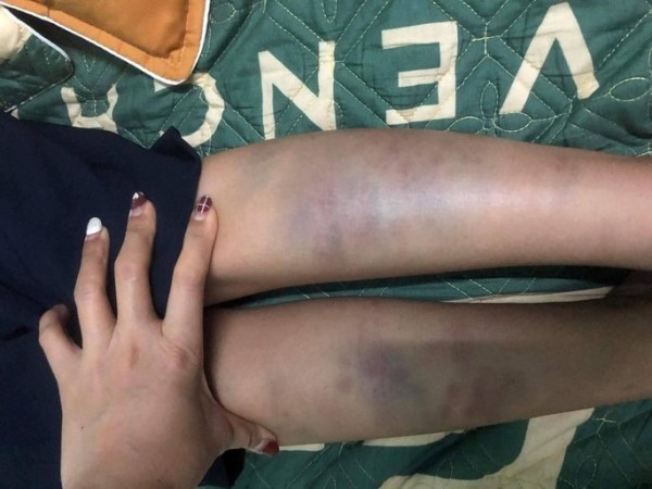 Vụ 'Học sinh ở Đà Nẵng hoảng loạn khi từ trường về nhà': Phụ huynh không đồng ý với kết luận