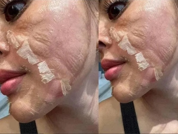 Bóc trần chiêu trò peel da như thật của 'vũ trụ hotgirl bán hàng online': Một cú lừa ngoạn mục!