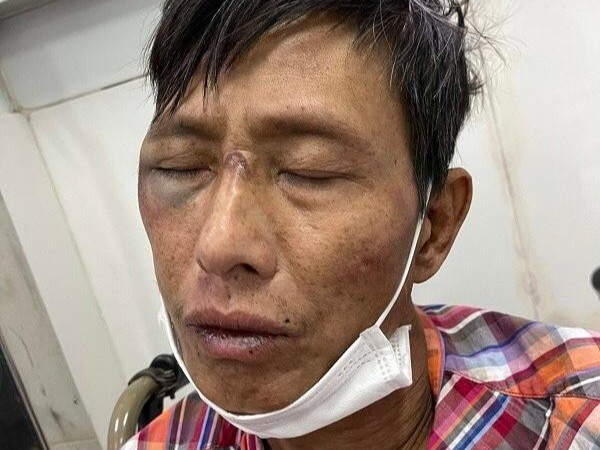 Đối tượng nhiễm HIV đâm trọng thương người dân, cầm rìu chống trả công an