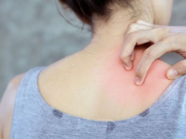 3 vị trí ngứa ngáy là dấu hiệu đường huyết tăng cao, bệnh tiểu đường đến rất gần: Chớ chủ quan