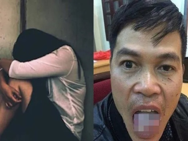 Động cơ đê hèn của kẻ hiếp dâm nữ sinh rồi bị cắn đứt lưỡi