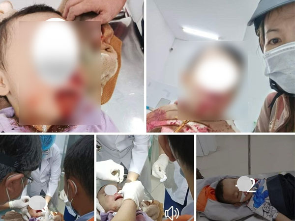 Làm rõ thông tin người mẹ tố CSGT đánh trúng con nhỏ 'gãy sống mũi, nứt xương mặt'