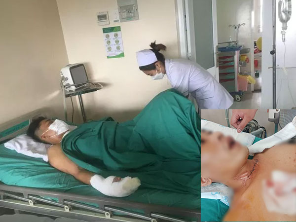Hãi hùng nam thanh niên bị dây diều cứa cổ khi đang chạy xe máy trên đường