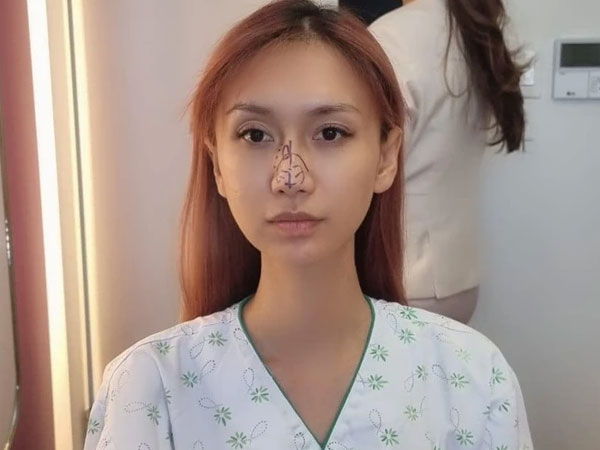 Không ưng ý ngoại hình sau nhiều lần phẫu thuật, Lynk Lee quyết tâm 'dao kéo' đến cùng