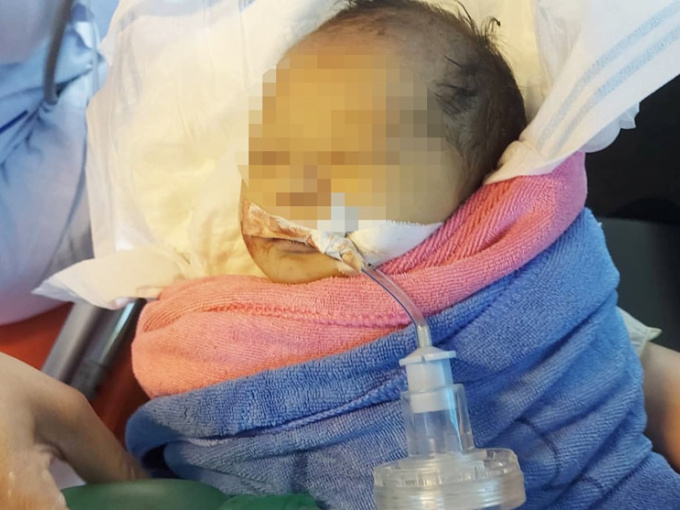 Xót xa bé sơ sinh bị bỏ rơi giữa rừng, trên người không một mảnh vải che thân, cơ thể tím tái, giòi bám đầy người
