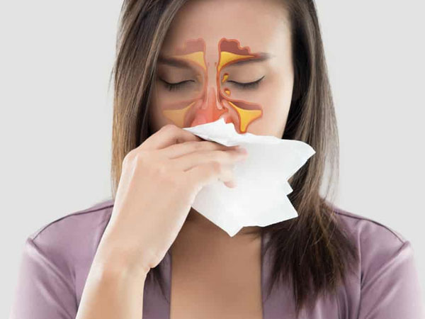 3 sai lầm khi điều trị viêm xoang mùa lạnh khiến bệnh ngày càng nặng hơn