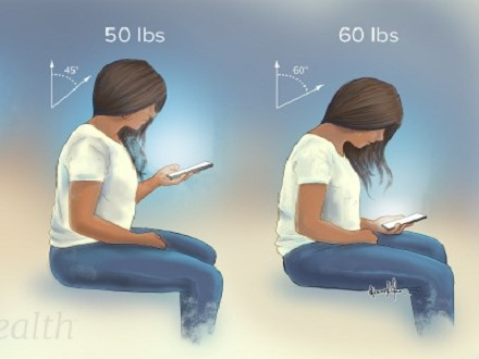 Thói quen 'giết chết' cột sống cổ, nhiều người thờ ơ