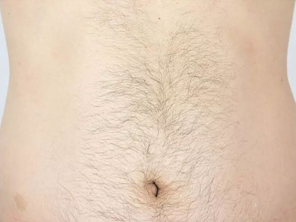 3 điểm càng nhiều lông càng phát lộc, quý khí thịnh vượng hơn người