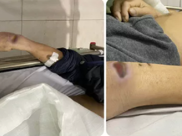 Hai cựu công an dùng nhục hình thế nào khiến người bị tạm giam tử vong?