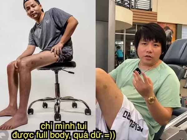 Khoa Pug tiết lộ sốc về sức khỏe, đòi chi thêm tiền tỷ để cao 1m8