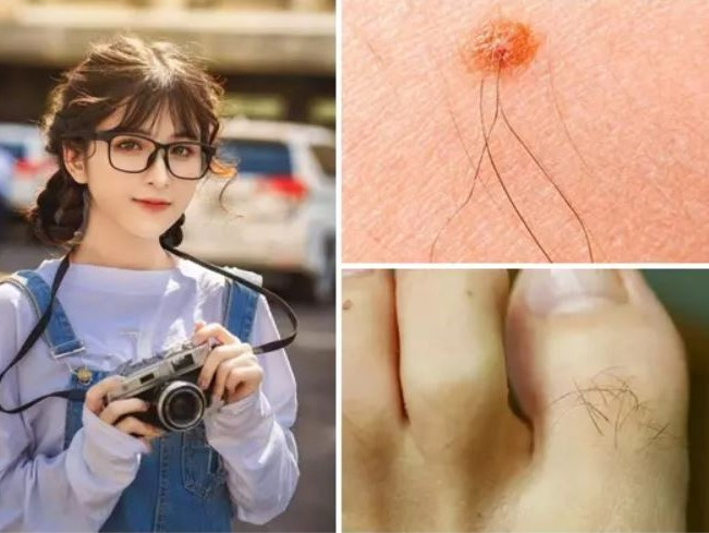 3 điểm càng nhiều lông càng phát lộc thịnh vượng hơn người