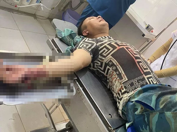 Gã đàn ông 'bắt sâu' trên ngực vợ hàng xóm, chém chồng trọng thương