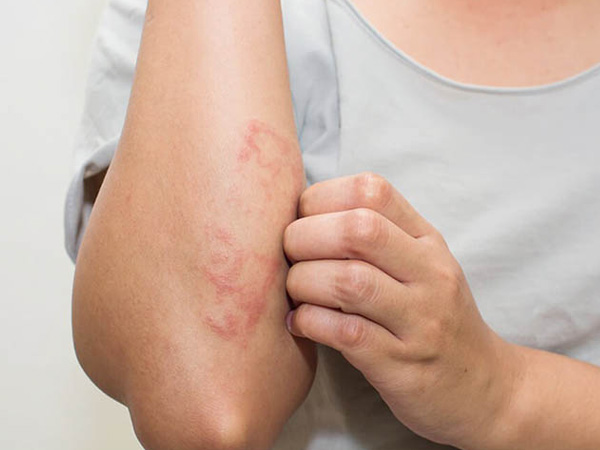 Ngứa ở 7 vị trí là dấu hiệu cảnh báo cơ thể có khối u ác tính, dù chỉ có 1 cũng nên đi khám ngay