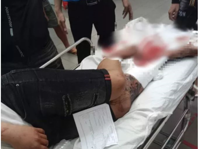 CLIP: Tài xế bị nhóm côn đồ chặn xe chém dã man