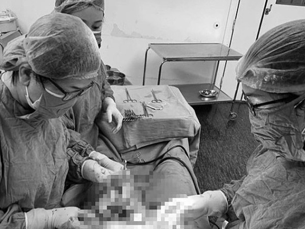 Hi hữu 50 triệu ca mới gặp 1: Người phụ nữ trẻ sinh thai đôi từ 2 tử cung