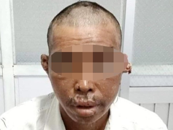 Người đàn ông bị hành hạ trên tàu cá đã về đất liền, đang làm việc với công an
