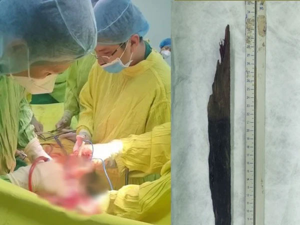 Tránh chó lao ra đường, thiếu niên 17 tuổi gặp tai nạn thương tâm
