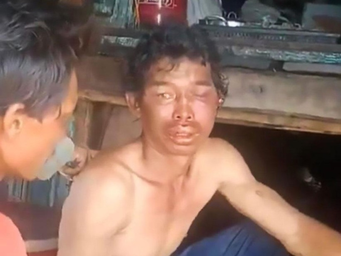 Vụ ngư dân bị hành hạ bằng kìm: Khởi tố, bắt giam 3 bị can