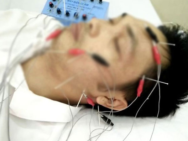 Nam thanh niên 29 tuổi ở Hà Nội lệch mặt, méo miệng vì thói quen nhiều người mắc khi trời lạnh
