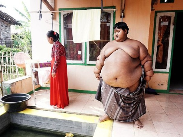 Màn 'lột xác' khó tin của cậu bé béo nhất thế giới