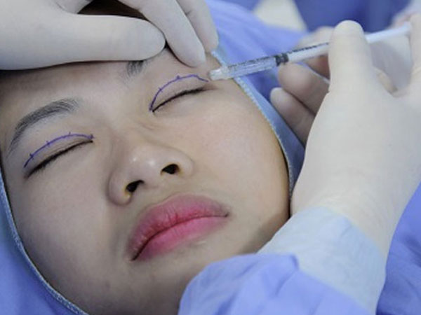Người phụ nữ suốt ba năm 'trợn mắt' vì cắt mí