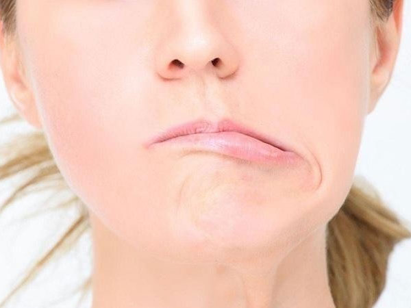 Trời lạnh, người trẻ méo mồm vì chủ quan