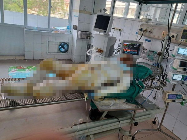 Vụ 3 con gái mang xăng đốt nhà mẹ đẻ ở Hưng Yên: Người mẹ đã 2 lần ghép da nhưng rất yếu