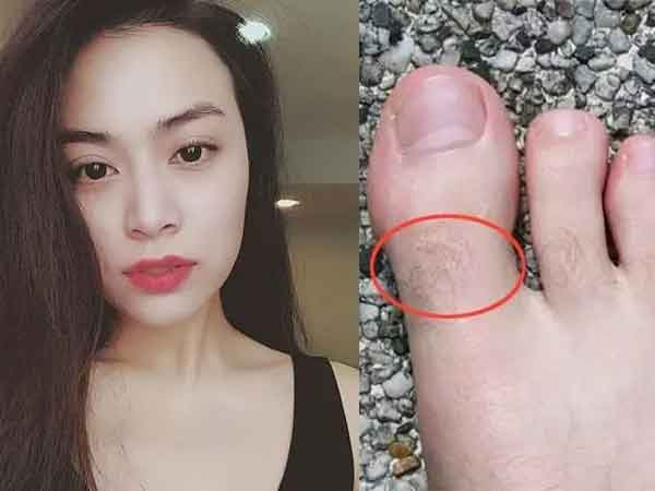 Xấu xấu chướng mắt nhưng lông mọc nhiều ở 4 vị trí này thì trời định giàu sang, lộc không cản nổi
