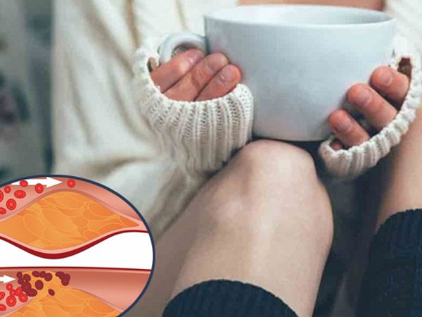 Món đồ uống vạn người mê mùa hè dùng không sao, mùa đông uống nhiều tay chân lạnh toát, máu dính như cháo