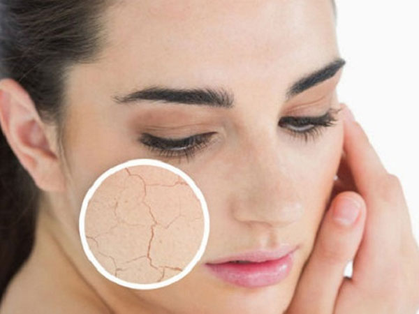 6 sai lầm khiến da nứt nẻ, gây ngứa vào ngày lạnh