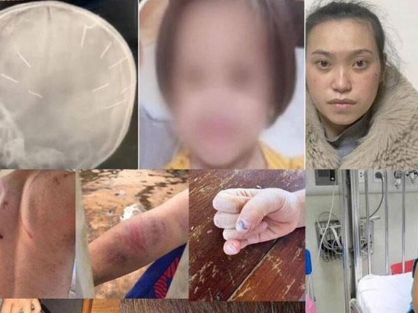 Sát hại con, đánh cháu... buồn lòng những vụ bạo hành trẻ em năm 2022