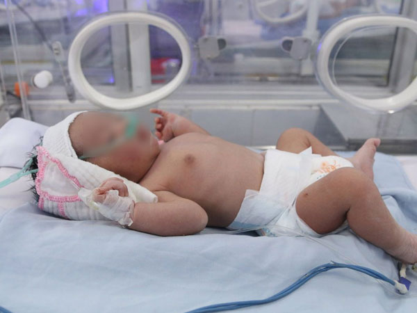 Bé trai bị bỏ rơi trong túi nilon ven đường