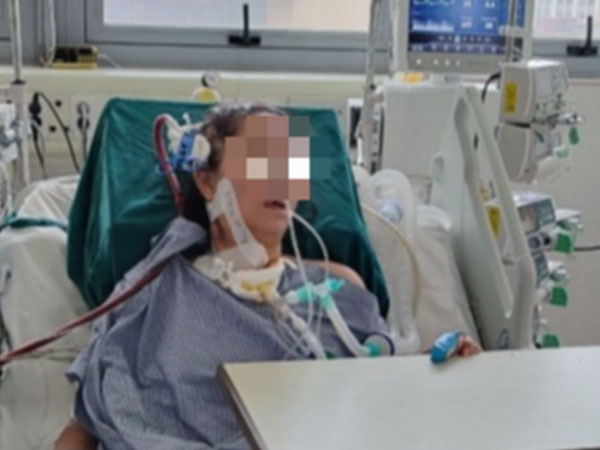 Lạm dụng corticoid tự điều trị cúm, nữ bệnh nhân 37 tuổi viêm phổi bội nhiễm, suy đa tạng