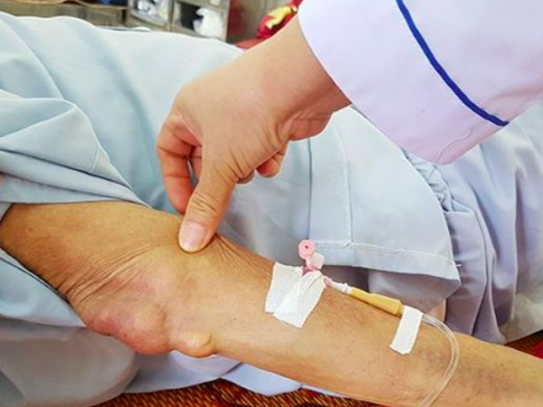 Bị bệnh gout có cần kiêng tuyệt đối protein từ thịt, cá, trứng?