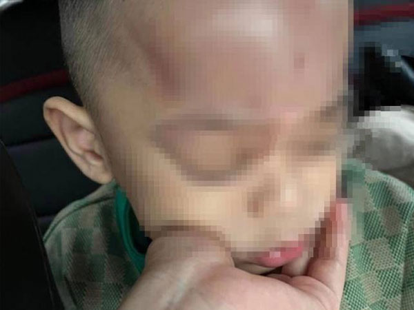 Xác minh thông tin trẻ bị bạo hành ở trường mầm non tại Đà Nẵng