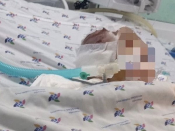 Vụ bé trai 6 tháng tuổi bị đánh đến xuất huyết não: Phẫn nộ lời khai của người giữ trẻ