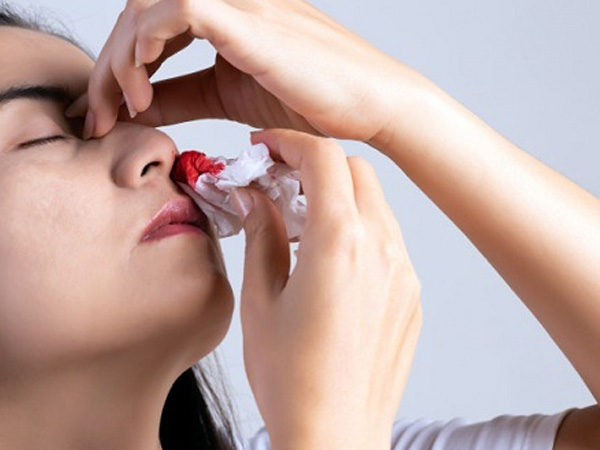 Nhiều người chảy máu cam mùa đông, dấu hiệu nào nên đi viện ngay?