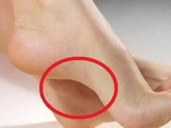 Phụ nữ có 5 đặc điểm này ở bàn chân, càng về già càng may mắn, tha hồ hưởng lộc