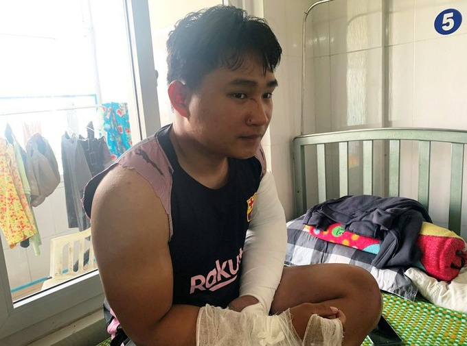 Giao hàng không nhận, cặp vợ chồng ở Quảng Ngãi đánh shipper gãy 2 tay