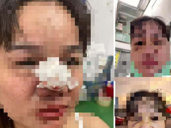 Người nổi tiếng kêu gọi từ thiện ở Quảng Nam bị 'bóc phốt' ăn chặn tiền nói gì?