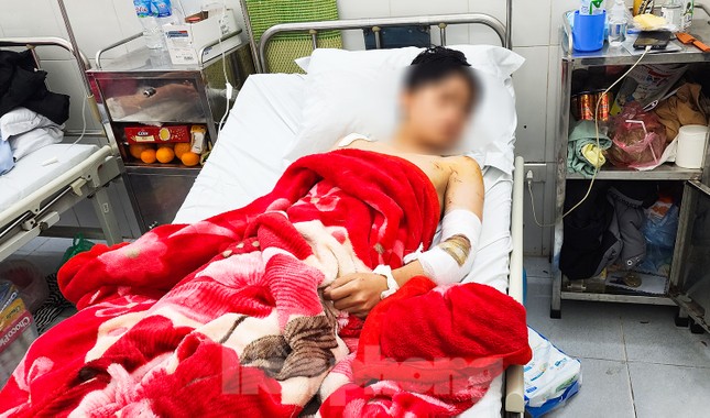 Nam sinh Lào Cai kể phút kinh hoàng bị hai con chó gần 60 kg thả rông cắn