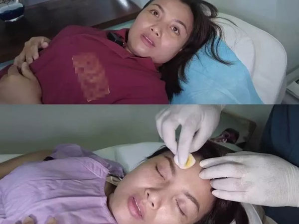 Ảnh cận nhan sắc Quỳnh Trần JP sau hơn 1 tuần chi khủng 'dao kéo'