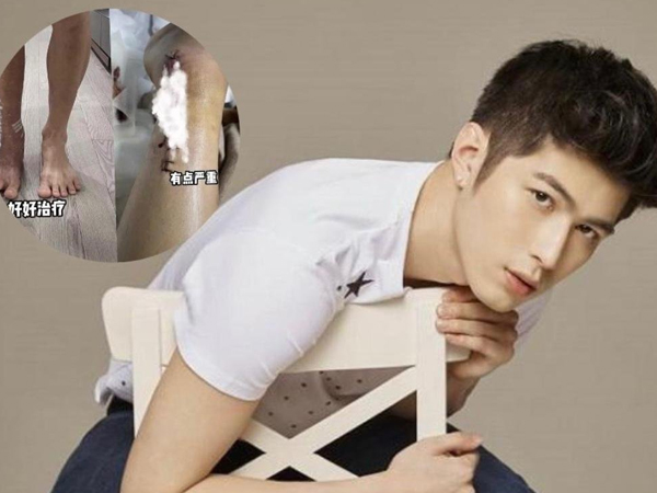 Một nam diễn viên bị tai nạn bị thương nặng, phải ngồi xe lăn