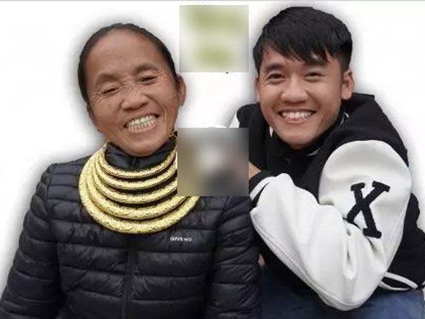 Bất ngờ diện mạo Bà Tân Vlog sau 4 tháng phẫu thuật thẩm mỹ