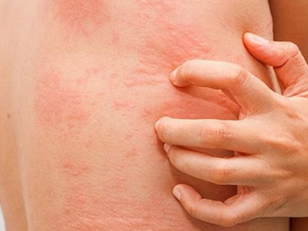 Ngứa 2 vị trí này báo hiệu gan đang kêu cứu, vị trí thứ nhất nhiều người làm tưởng bệnh ngoài da